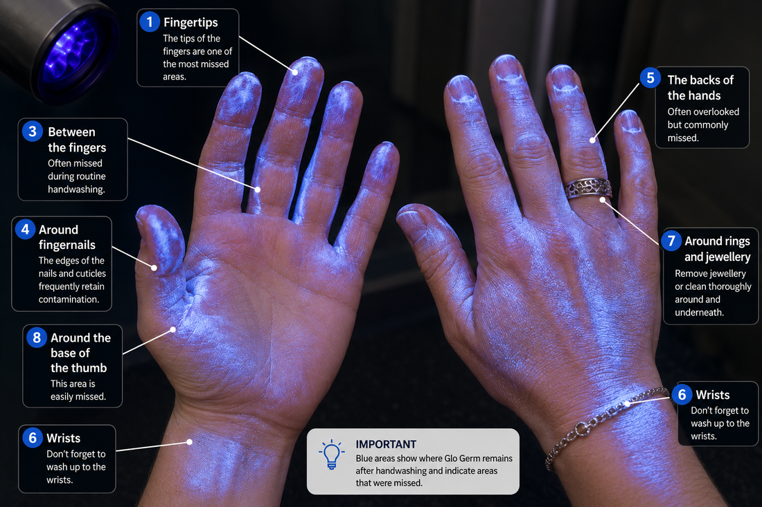 How to Audit Hand Hygiene Using Fluorescent Gel